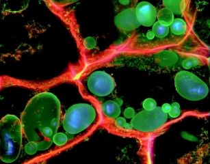 Potato_cells_copysmall2.jpg